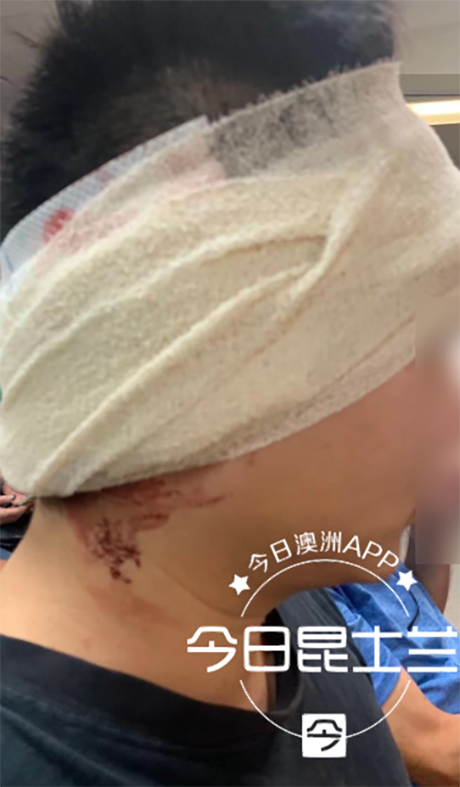 澳华男停车场遇袭,被人从身后锤头,流血不止,“现在一起身天旋地转!”华人遇到这种情况警惕