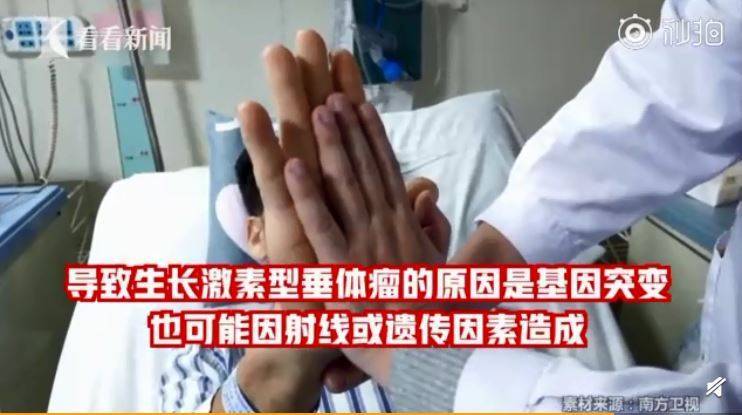 以为发福…中年男「长高变胖」 竟是颅内肿瘤惹祸