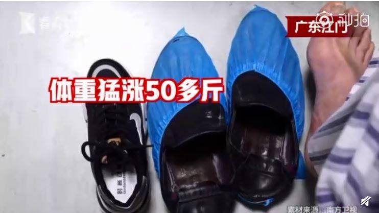 以为发福…中年男「长高变胖」 竟是颅内肿瘤惹祸