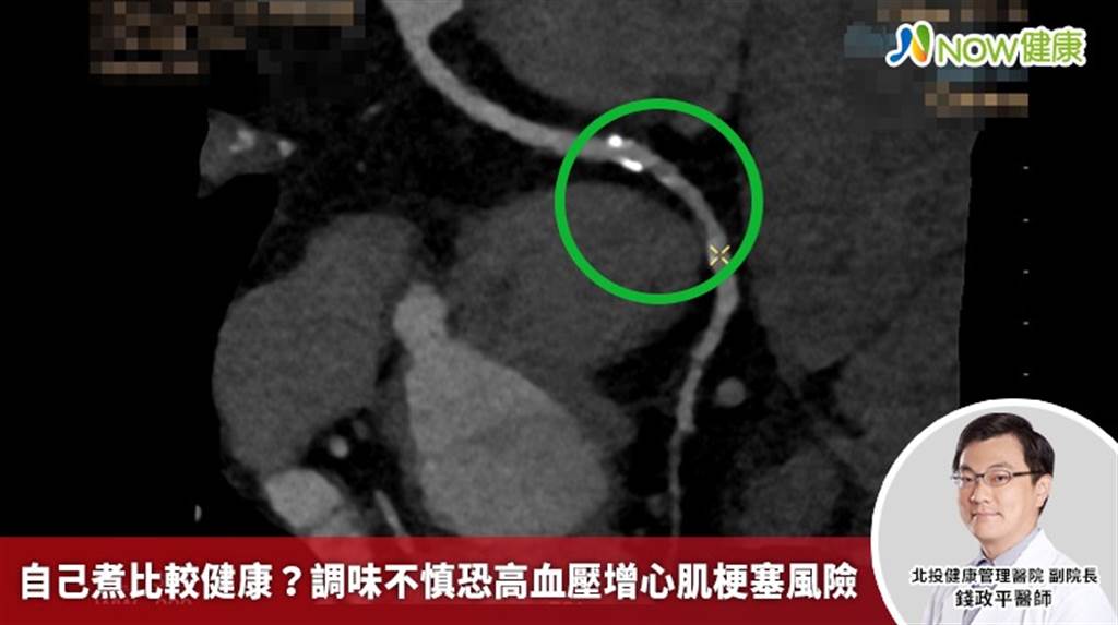 自煮比外食健康?医:忽略「调味比例」 同样伤害心血管